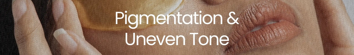 Pigmentation & Uneven Tone